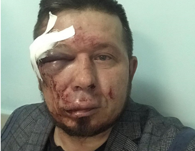 Активиста ОНФ жестоко избили в Новосибирске