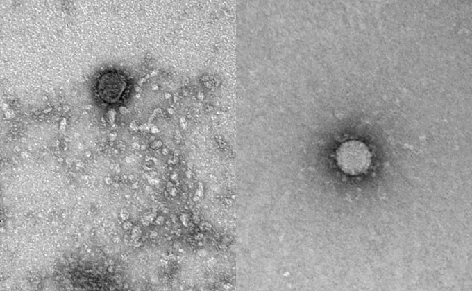 Фото коронавируса-2020 получили новосибирские ученые