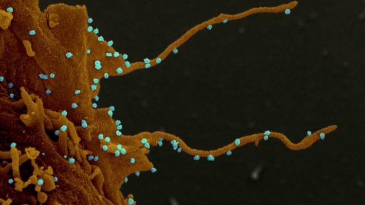 Американские учёные сообщили о «зловещих щупальцах» коронавируса