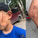 Новосибирец жестоко избил 7-летнего пасынка шнуром от чайника