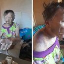 Пенсионерка попала в больницу после избиения сыном в Октябрьском районе Пенсионерка попала в больницу после избиения сыном в Октябрьском районе